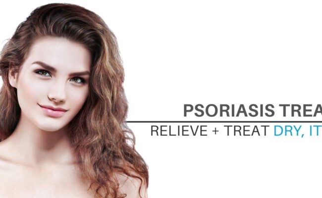 Psoriasis_Treatment_