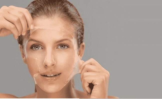 what-is-a-chemical-peel-charlotte-nc-e1429027329930